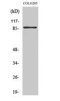 TLK2 Polyclonal Antibody