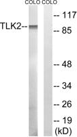 TLK2 Polyclonal Antibody