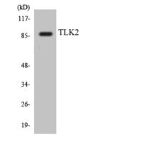 TLK2 Polyclonal Antibody