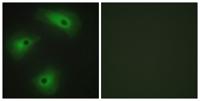 TMEM16A Polyclonal Antibody