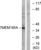 TMEM185A Polyclonal Antibody