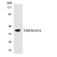 TMEM185A Polyclonal Antibody