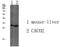 Tmem72 Polyclonal Antibody