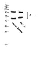 TMPO Polyclonal Antibody