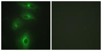 TMPRSS3 Polyclonal Antibody