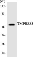 TMPRSS3 Polyclonal Antibody