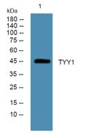 TYY1 Polyclonal Antibody