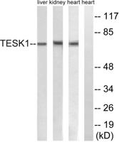 TESK1 Polyclonal Antibody