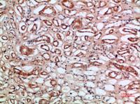 Tetranectin Polyclonal Antibody