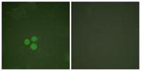 TFDP1 Polyclonal Antibody