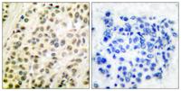 TFDP1 Polyclonal Antibody