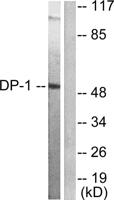 TFDP1 Polyclonal Antibody