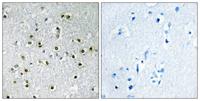 TFE3 Polyclonal Antibody