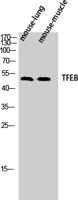 TFEB Polyclonal Antibody