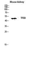 TFEB Polyclonal Antibody