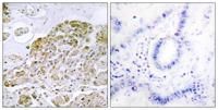 TFEB Polyclonal Antibody