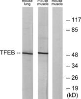 TFEB Polyclonal Antibody