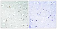 TFIIA-α Polyclonal Antibody