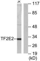 TFIIE-β Polyclonal Antibody