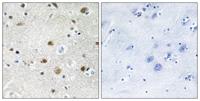 TFIIIB90-1 Polyclonal Antibody