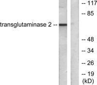 TGase2 Polyclonal Antibody