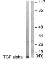 TGFα Polyclonal Antibody