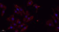 TGFβ RII Polyclonal Antibody