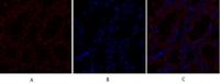 TGFβ RII Polyclonal Antibody