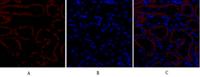 TGFβ RII Polyclonal Antibody