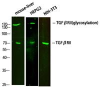 TGFβ RII Polyclonal Antibody