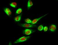 Tyrosine Hydroxylase rabbit pAb