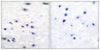 Tyrosine Hydroxylase rabbit pAb