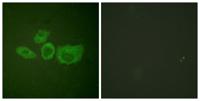 Tyrosine Hydroxylase rabbit pAb