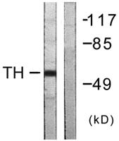 TH Polyclonal Antibody