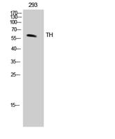 Tyrosine Hydroxylase rabbit pAb