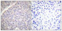 Tyrosine Hydroxylase rabbit pAb