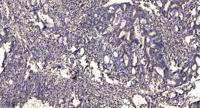 THIK-2 Polyclonal Antibody