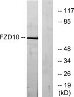 Frizzled-10 Polyclonal Antibody