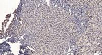 Thymidine Kinase Polyclonal Antibody