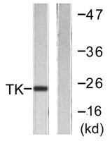 Thymidine Kinase Polyclonal Antibody