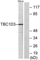 TBC1D3A/B/C Polyclonal Antibody