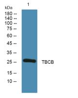 TBCB Polyclonal Antibody