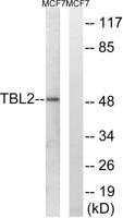 TBL2 Polyclonal Antibody