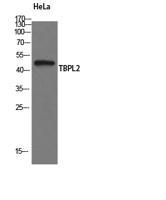 TBPL2 Polyclonal Antibody