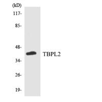 TBPL2 Polyclonal Antibody