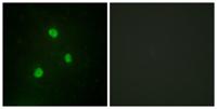 TBX1 Polyclonal Antibody