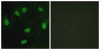 TBX15/18 Polyclonal Antibody