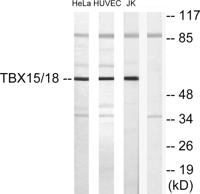 TBX15/18 Polyclonal Antibody