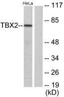 TBX2 Polyclonal Antibody