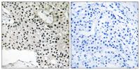 TCEAL4 Polyclonal Antibody